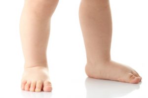 عوامل افزایش دهنده صافی کف پا