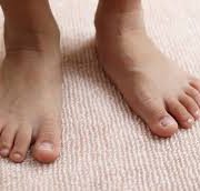 درمان کف پای صاف دکتر رجایی فلوشیپ جراحی پا